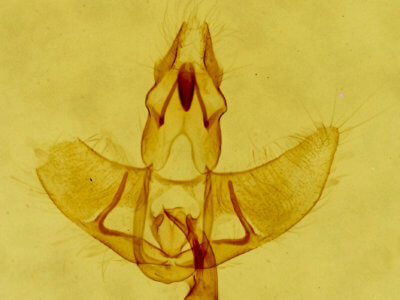 genitalia view of adult Agonopterix atrodorsella