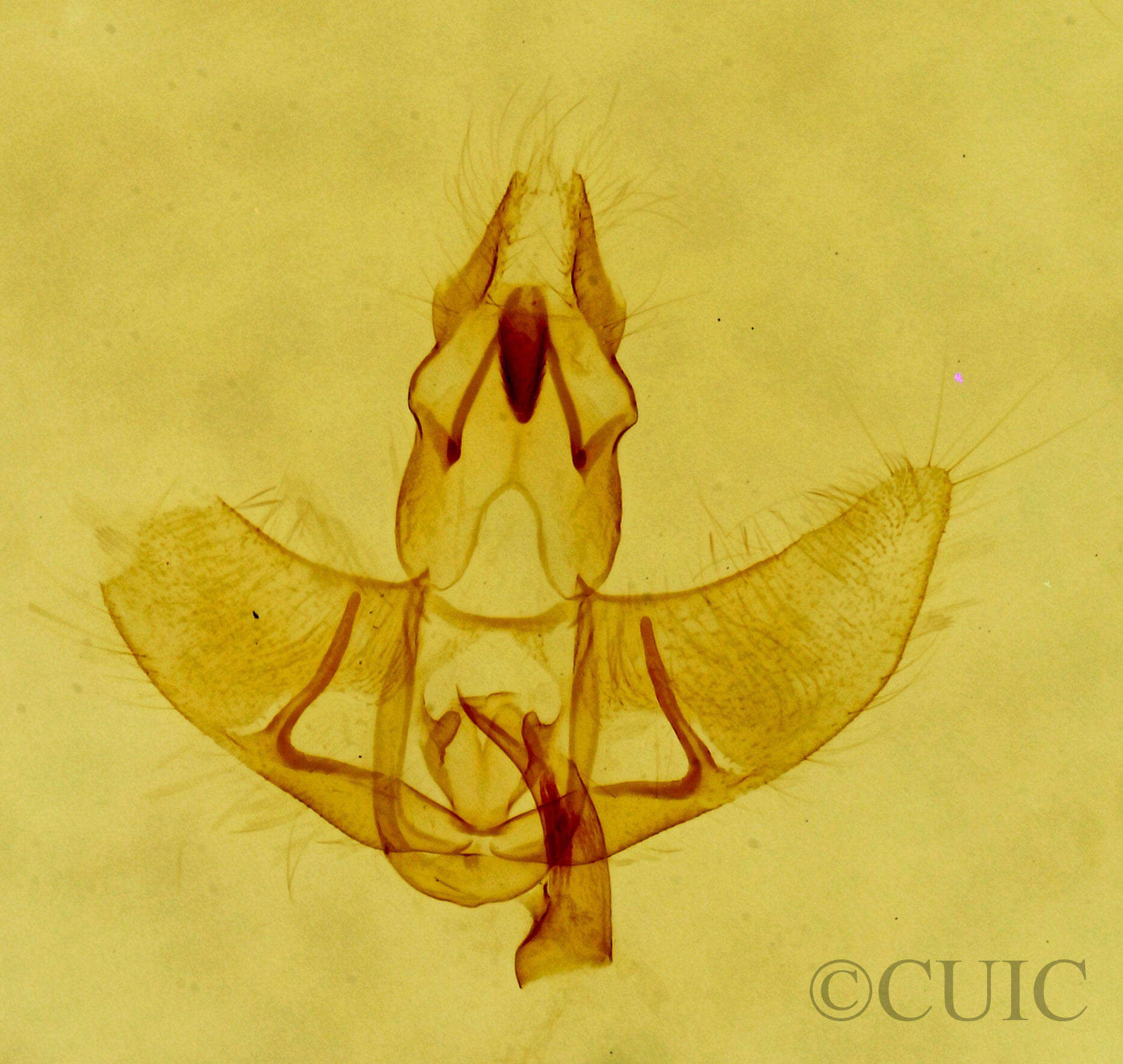 genitalia view of adult Agonopterix atrodorsella