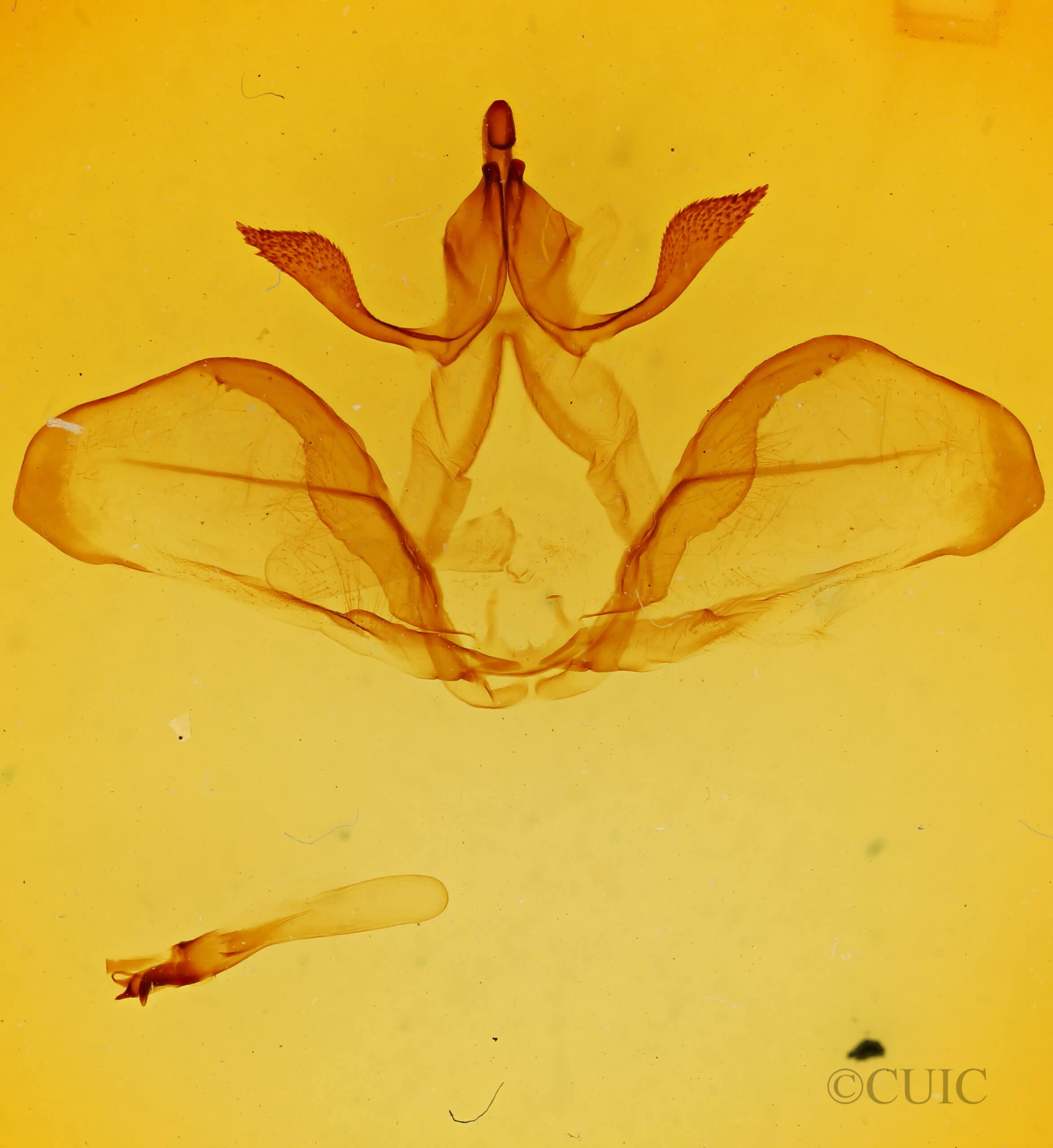 genitalia view of adult Ianassa paradisus