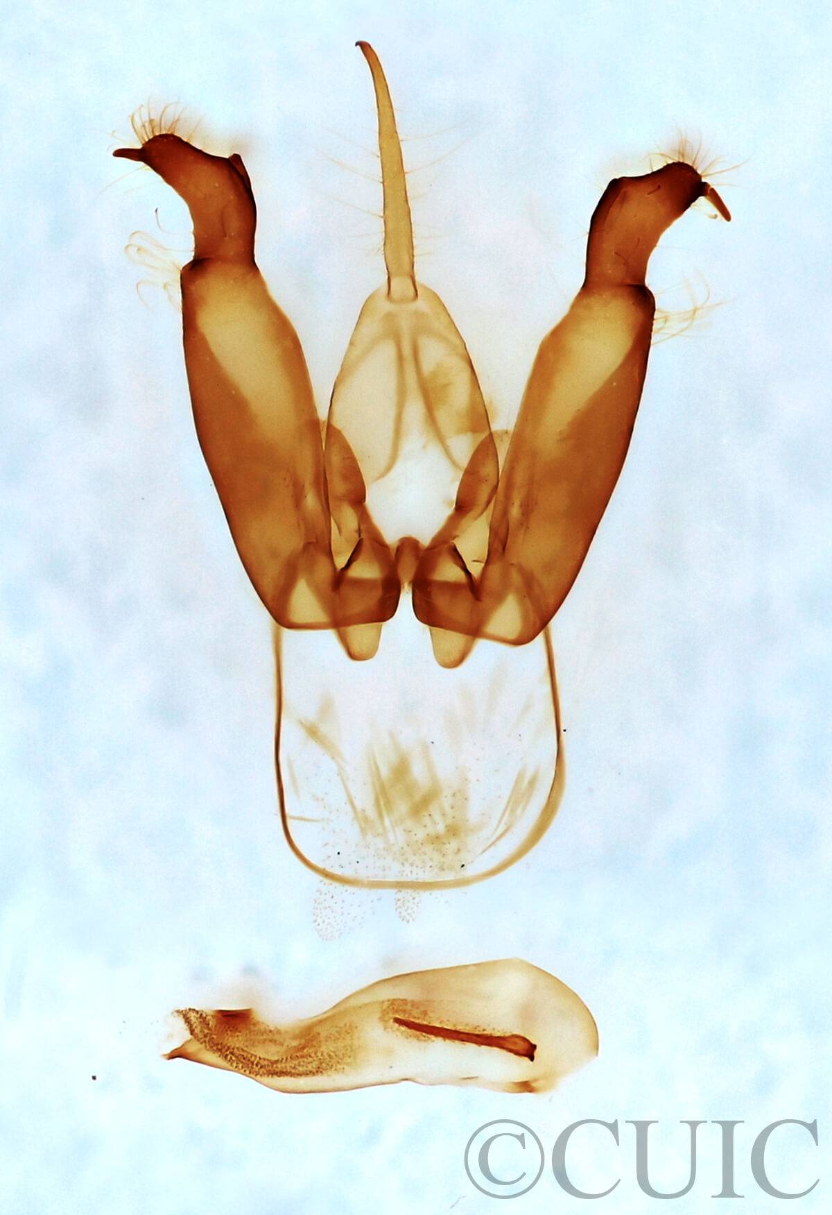 genitalia view of adult Lithosiini