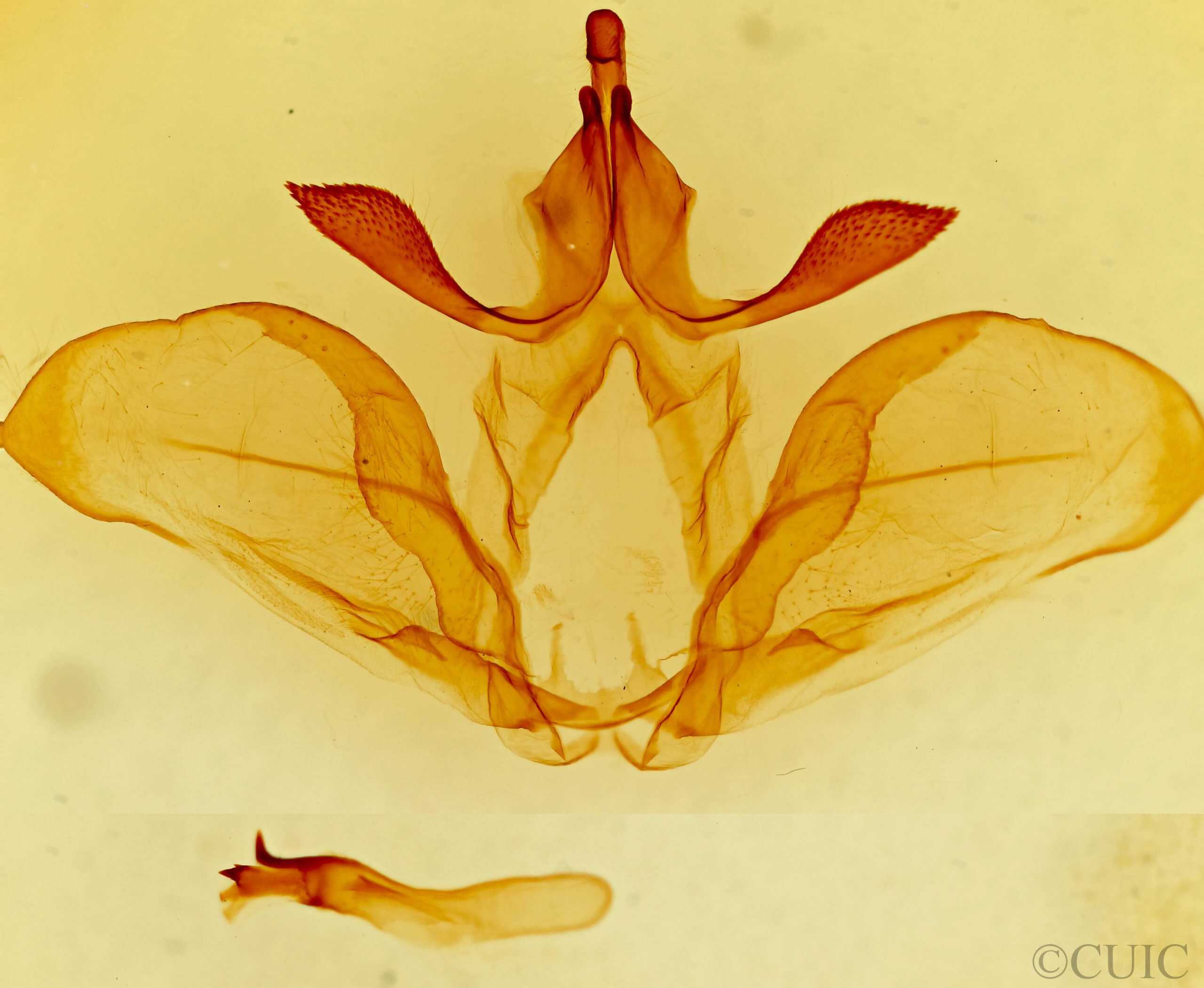 genitalia view of adult Ianassa paradisus