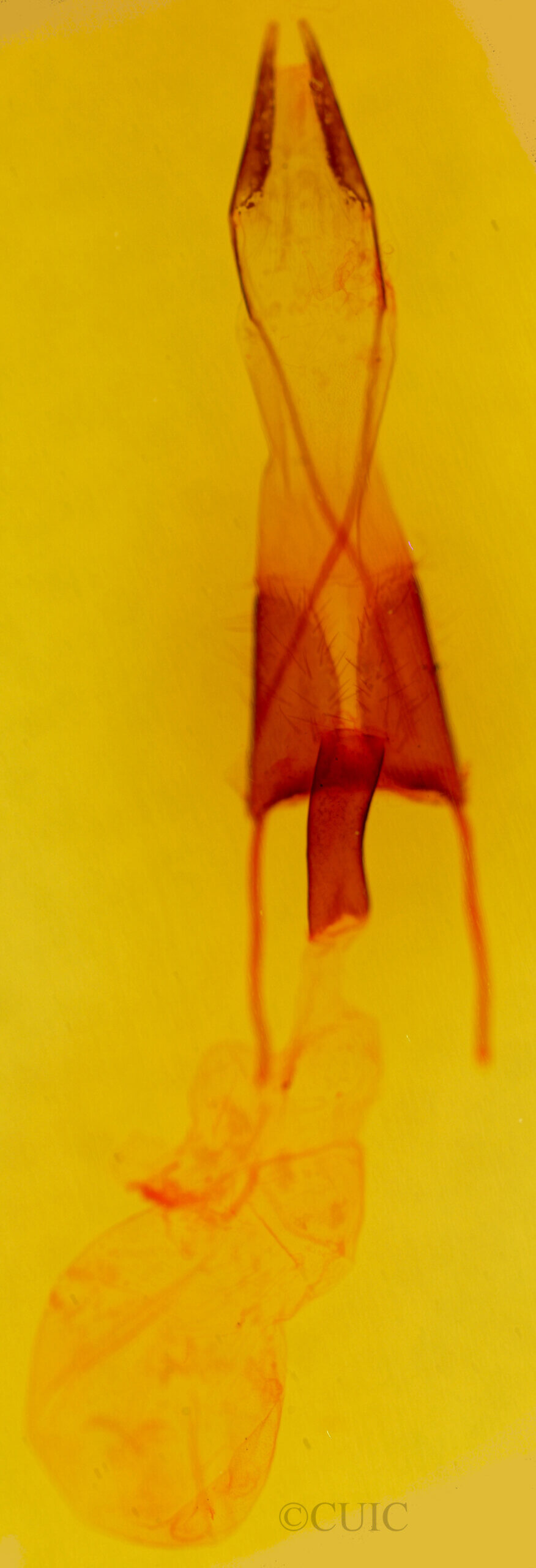 genitalia view of adult Protorthodes ustulata