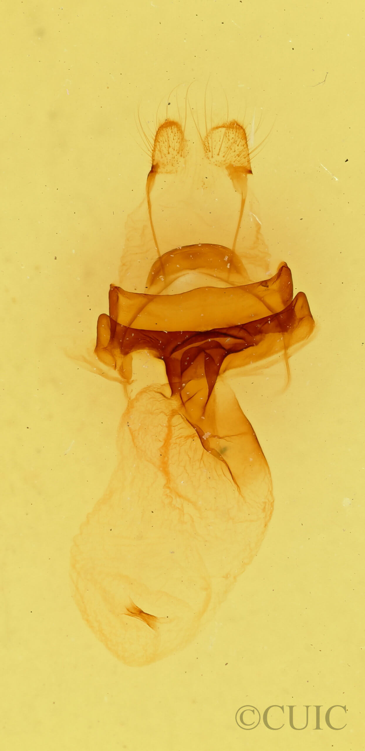 genitalia view of adult Symmerista zacualpana
