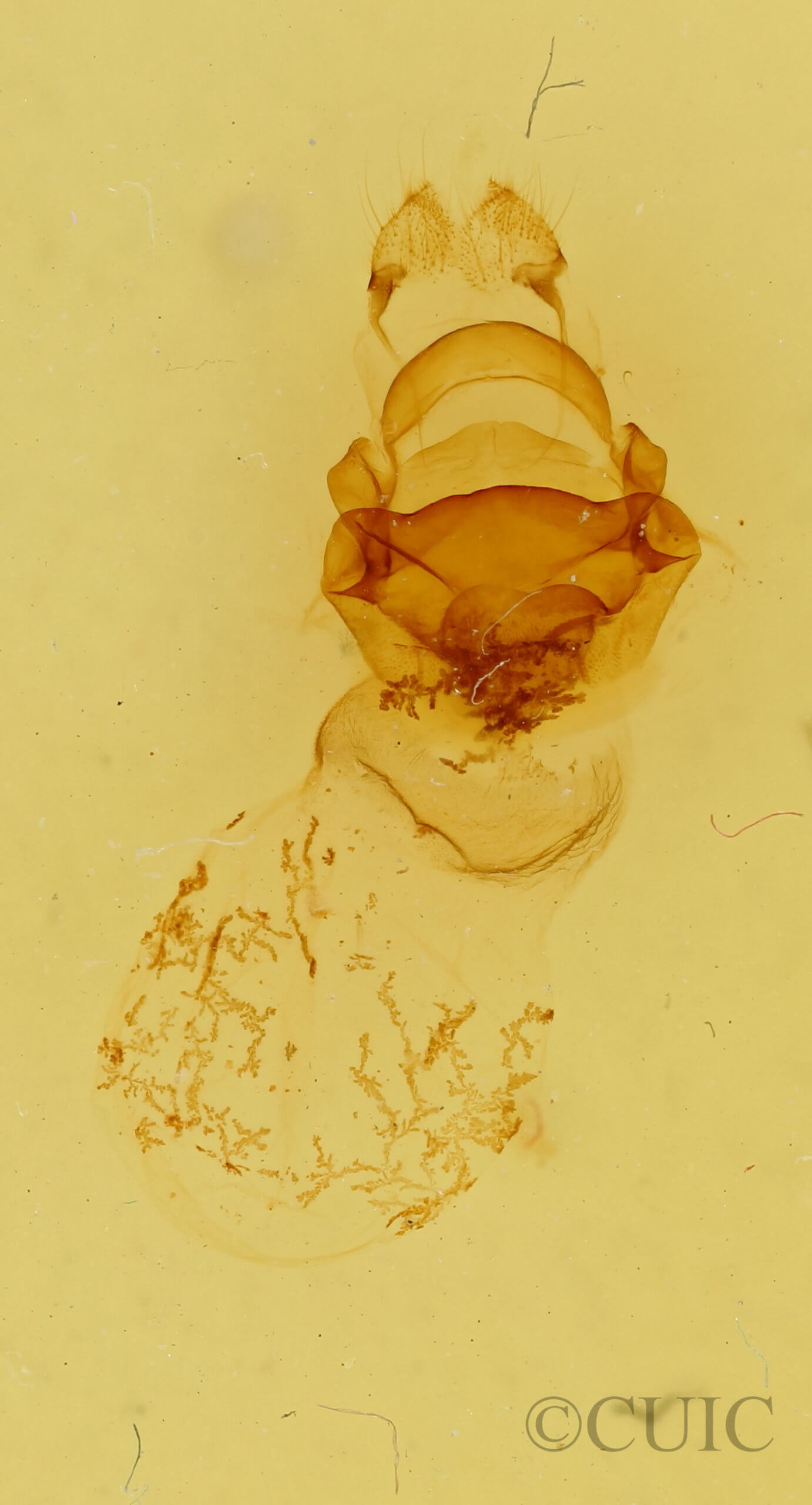 genitalia view of adult Symmerista leucitys