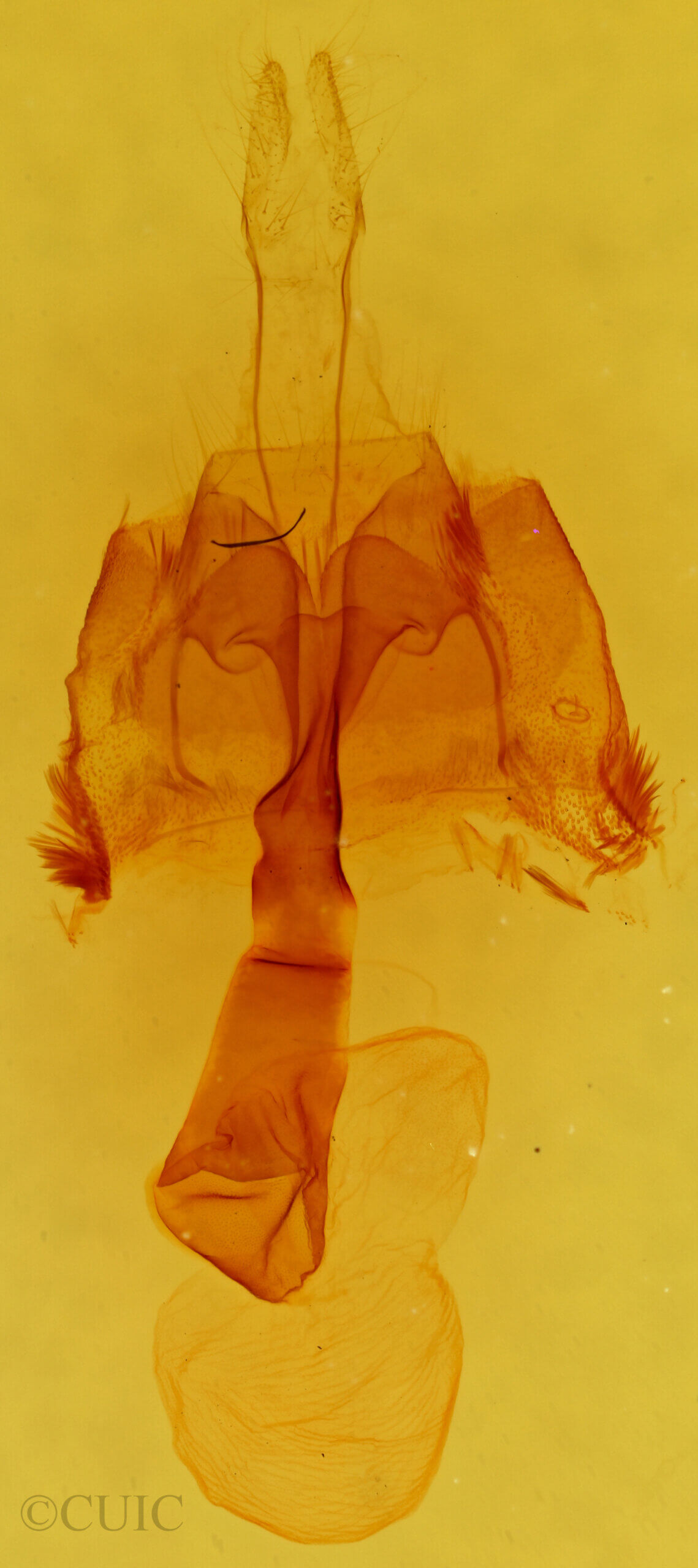 genitalia view of adult Homorthodes furfurata uniformis