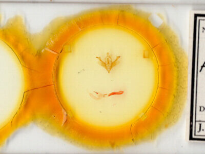 slide view of adult Anhimella perbrunnea