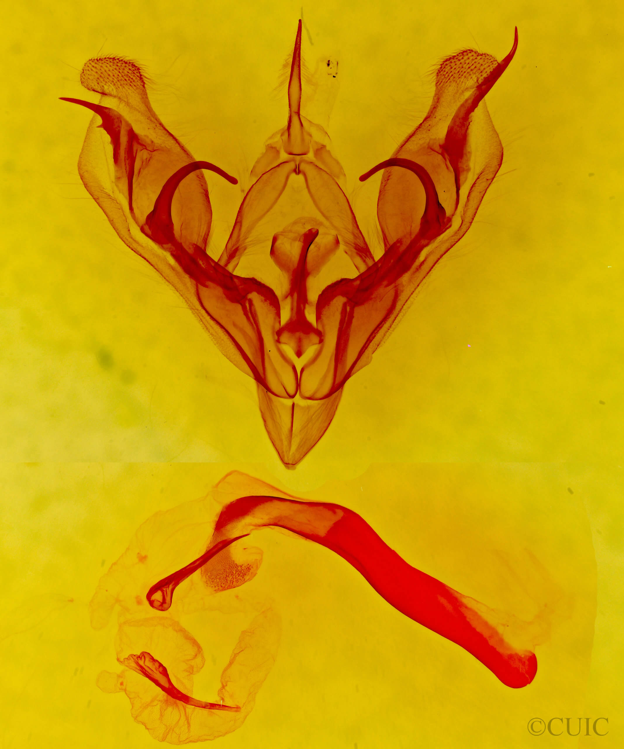 genitalia view of adult Protorthodes rufula