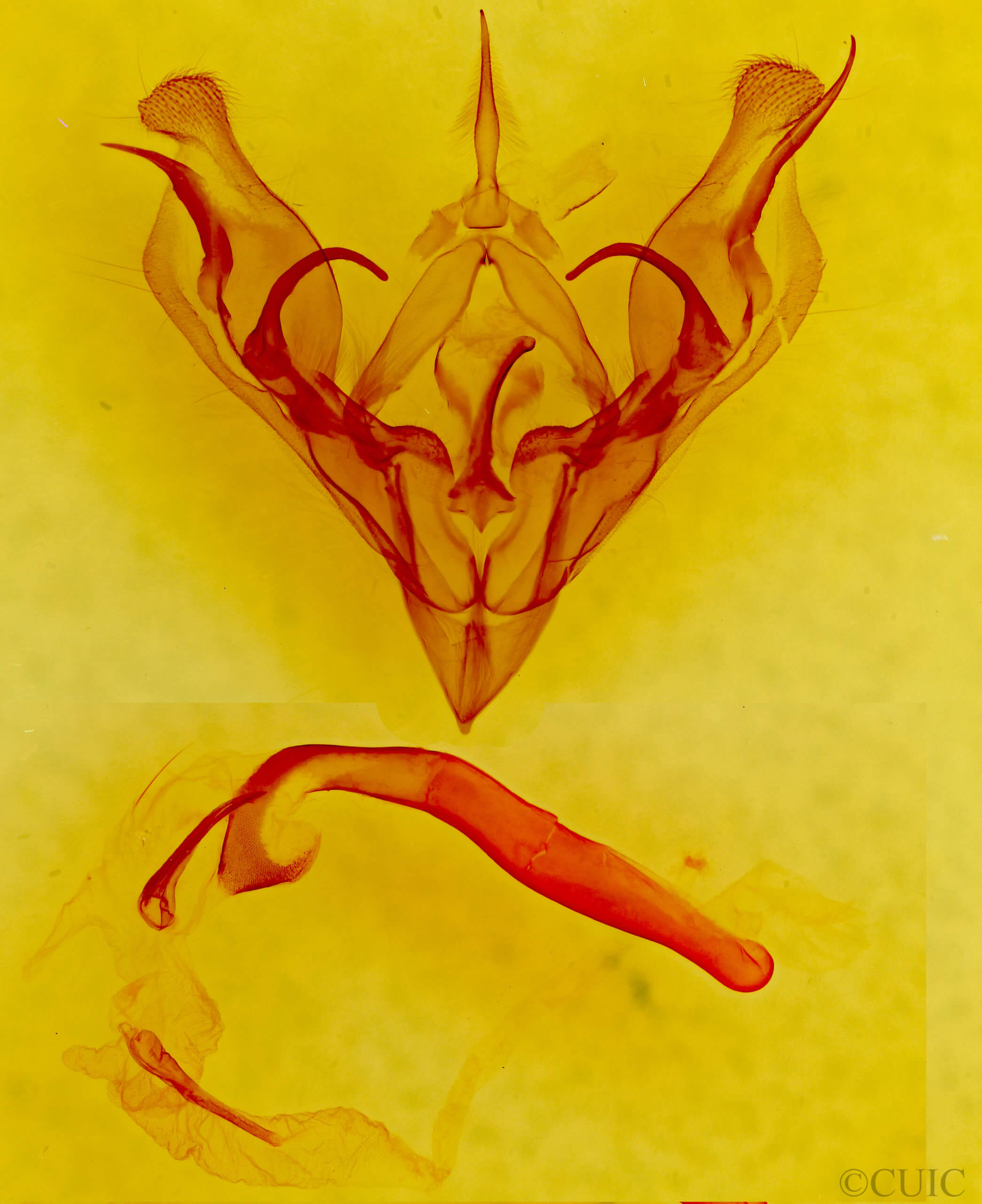 genitalia view of adult Protorthodes rufula