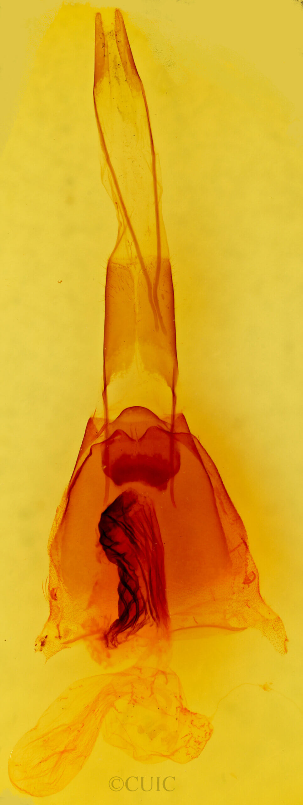 genitalia view of adult Protorthodes rufula
