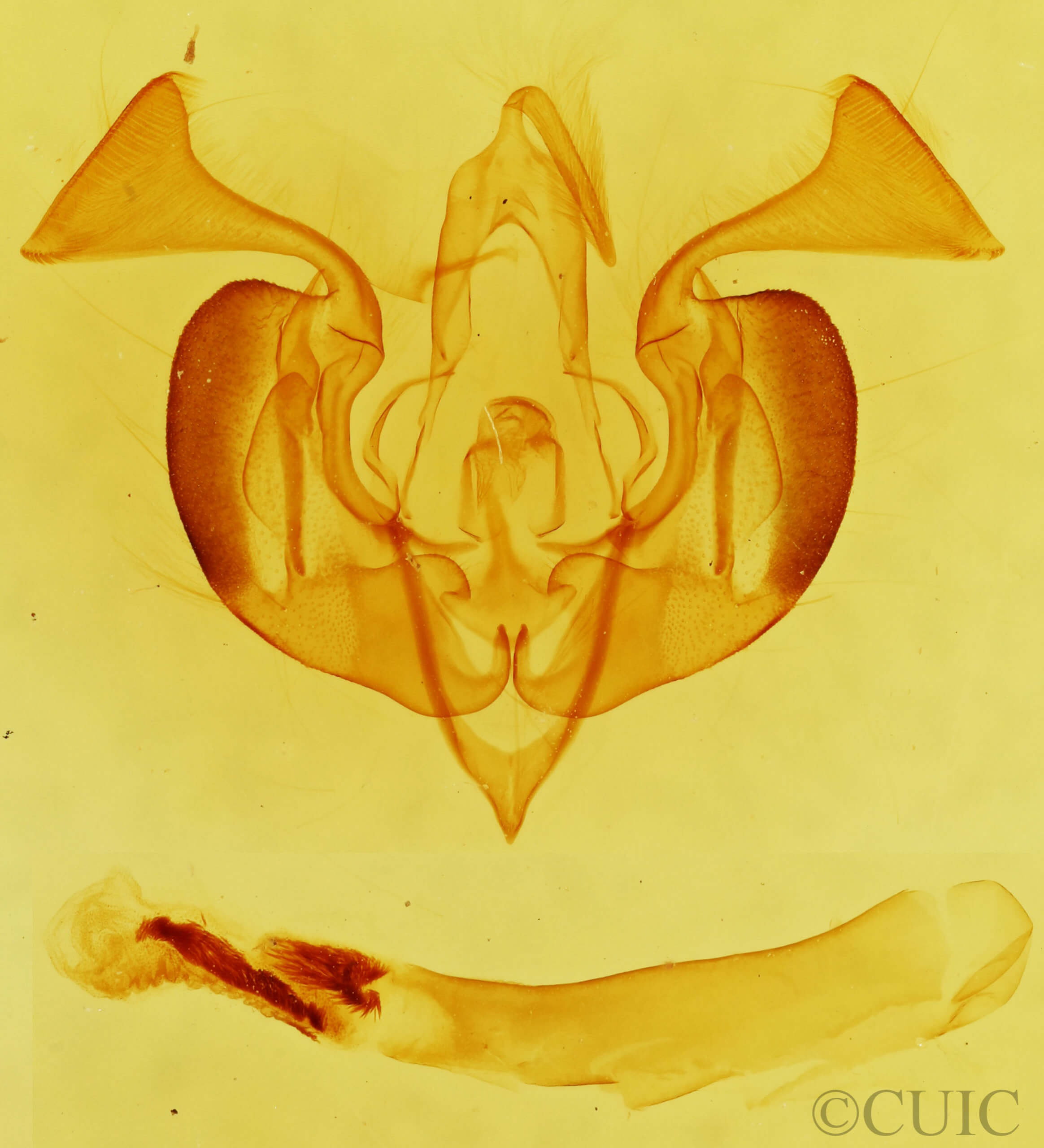 genitalia view of adult Lacinipolia basiplaga