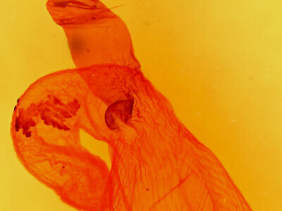 genitalia view of adult Lacinipolia basiplaga