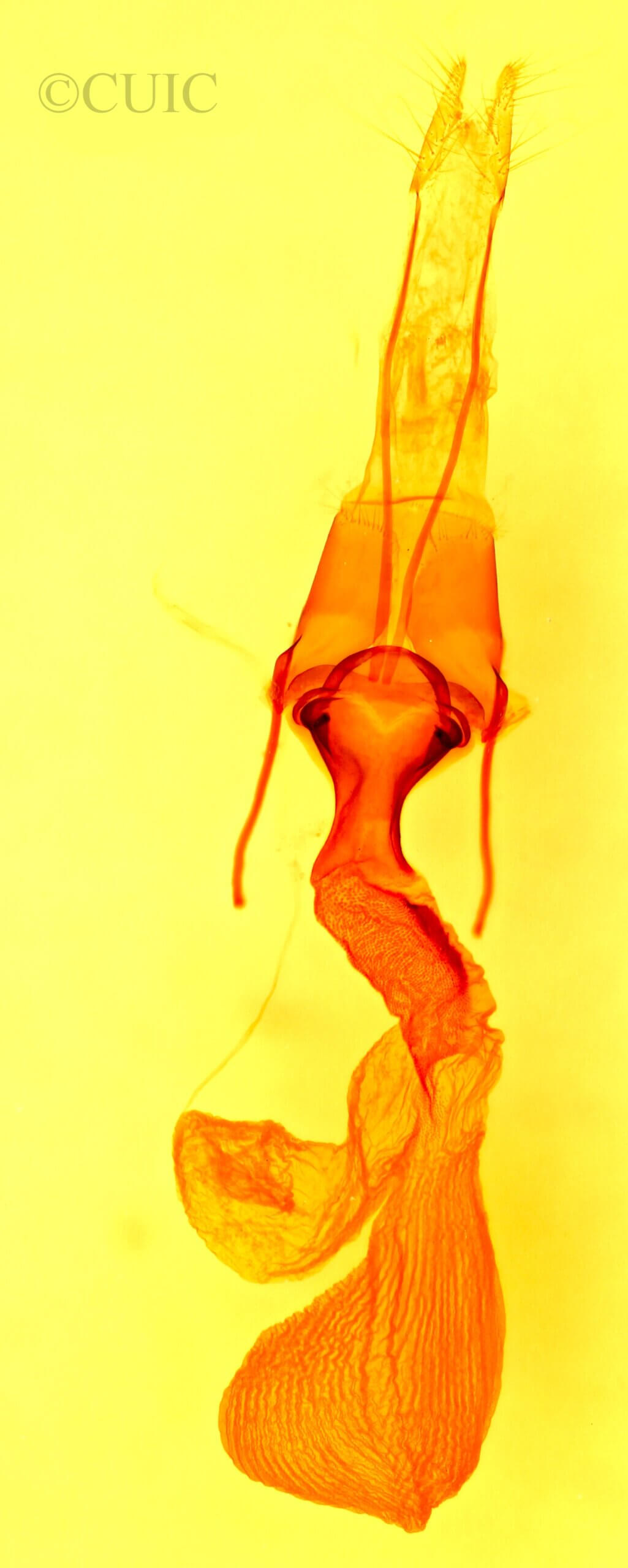 genitalia view of adult Lacinipolia triplehorni