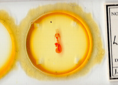 slide view of adult Lacinipolia strigicollis