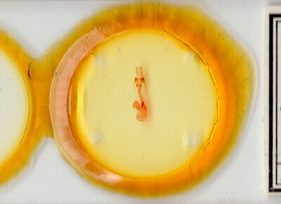 slide view of adult Lacinipolia strigicollis