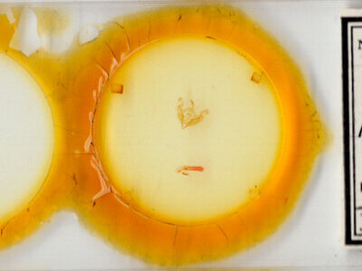 slide view of adult Miodera stigmata