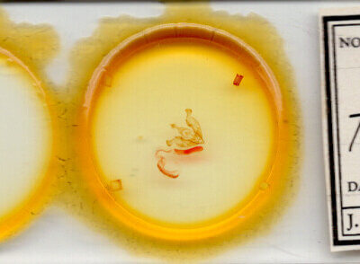 slide view of adult Trichocerapoda comstocki