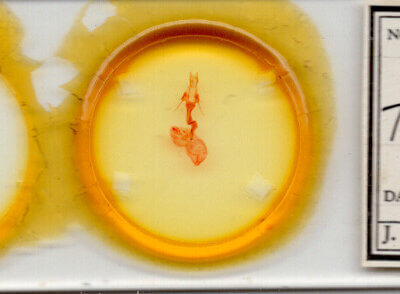 slide view of adult Trichocerapoda comstocki