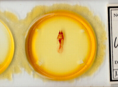 slide view of adult Hypotrix lunata