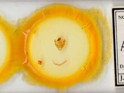 slide view of adult Hypotrix trifascia