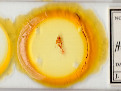 slide view of adult Hypotrix trifascia