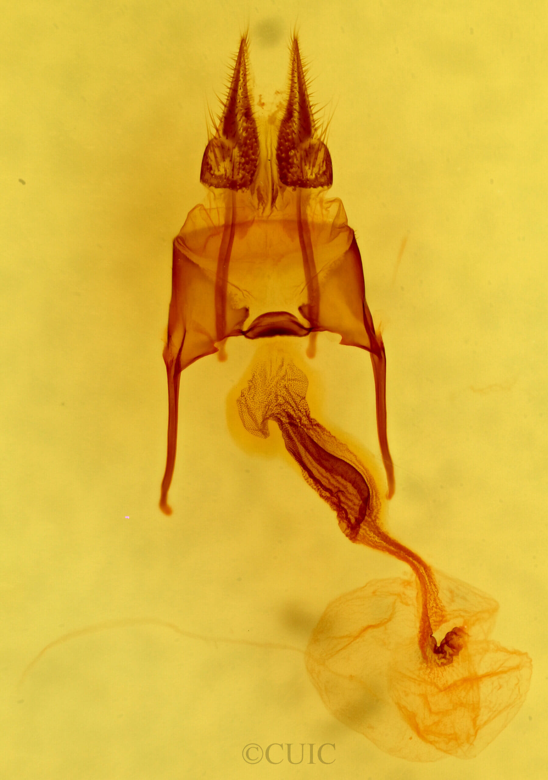 genitalia view of adult Hypotrix trifascia