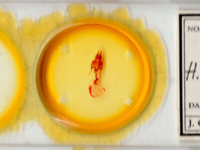 slide view of adult Hypotrix hueco