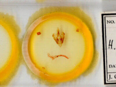 slide view of adult Hypotrix hueco