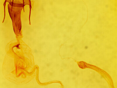 genitalia view of adult Hypotrix ferricola