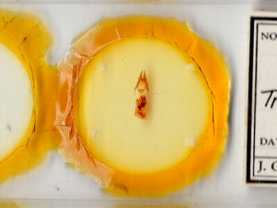 slide view of adult Hypotrix ocularis