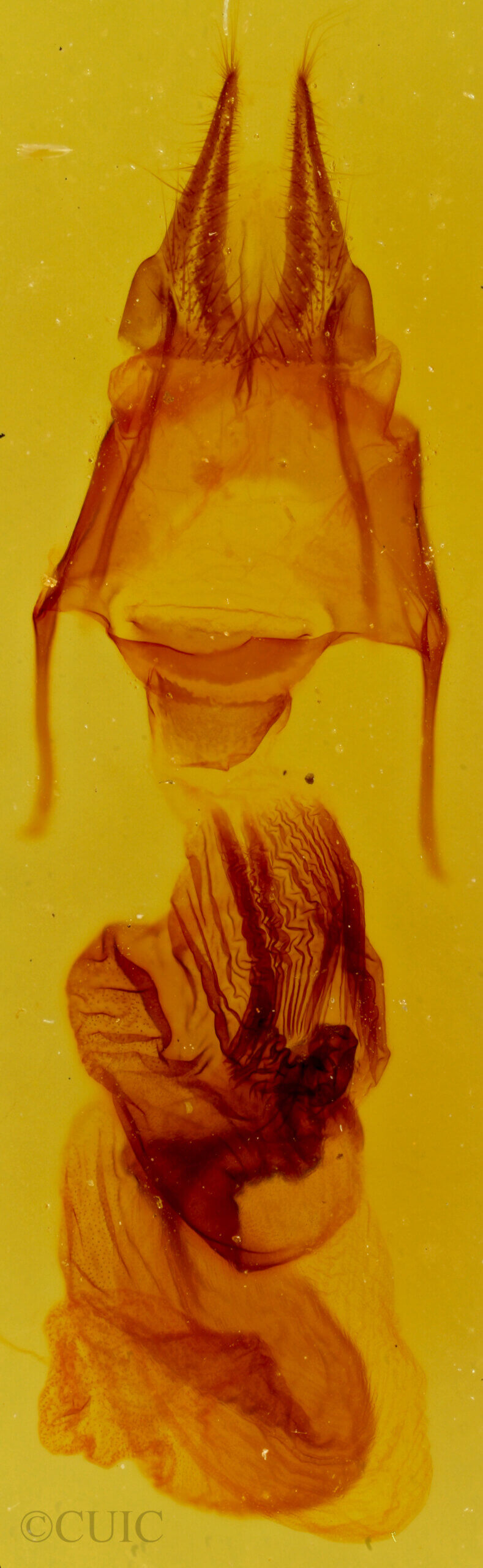 genitalia view of adult Hypotrix ocularis