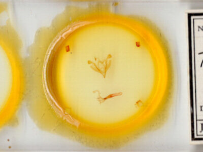 slide view of adult Hypotrix diplogramma