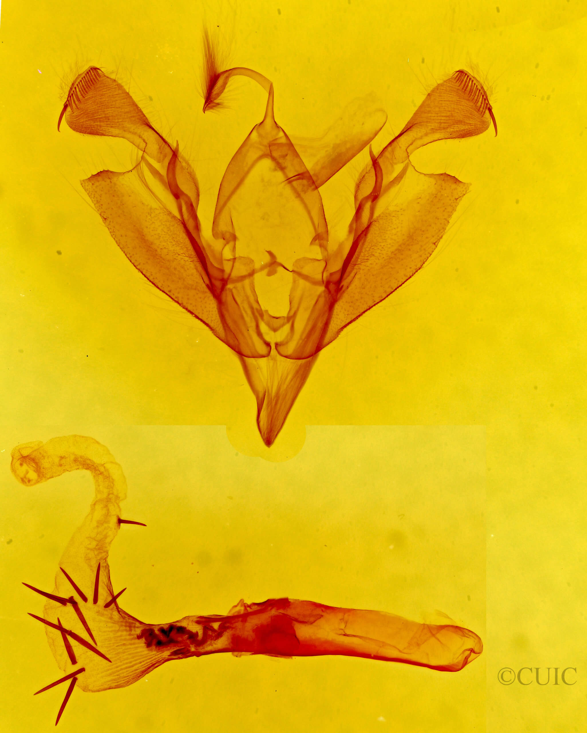 genitalia view of adult Hypotrix diplogramma
