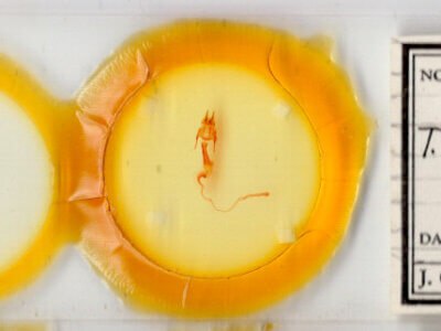 slide view of adult Hypotrix diplogramma