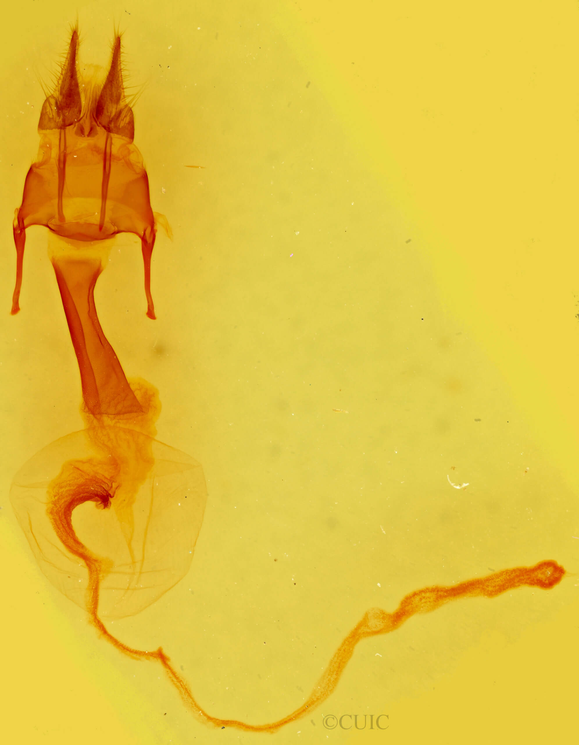 genitalia view of adult Hypotrix diplogramma