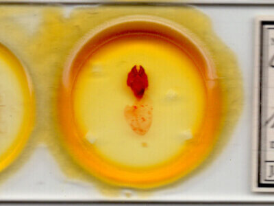 slide view of adult Charadra tapa