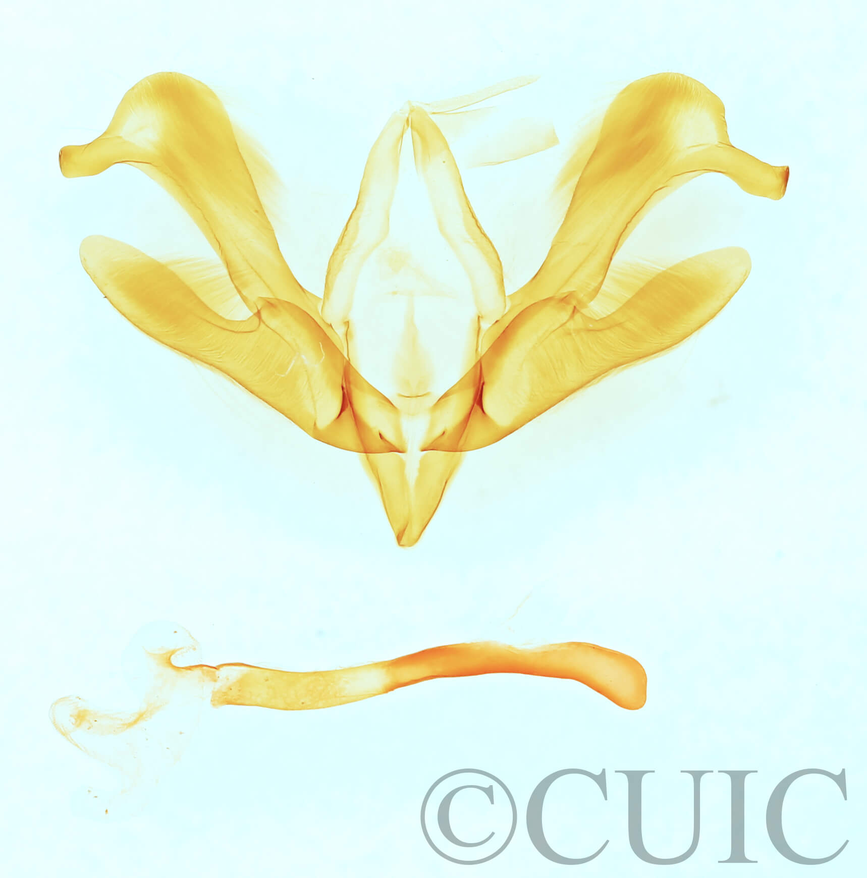 genitalia view of adult Ogdoconta rufipenna