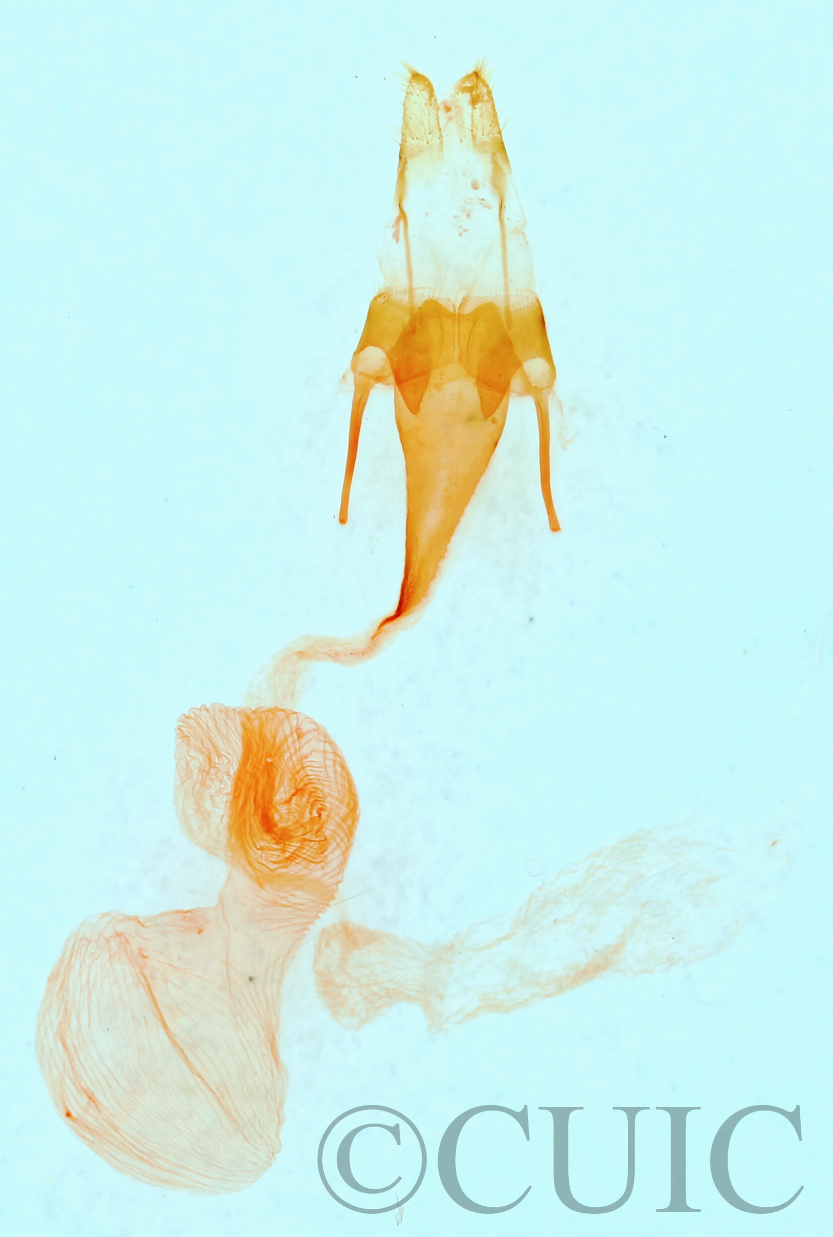 genitalia view of adult Ogdoconta rufipenna