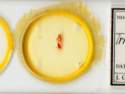 slide view of adult Hypotrix naglei