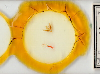 slide view of adult Hypotrix optima