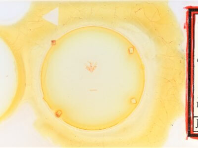 slide view of adult Nychioptera accola