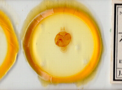 slide view of adult Zale obliqua