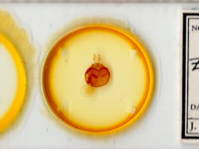 slide view of adult Zale submediana