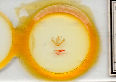 slide view of adult Sosxetra grata