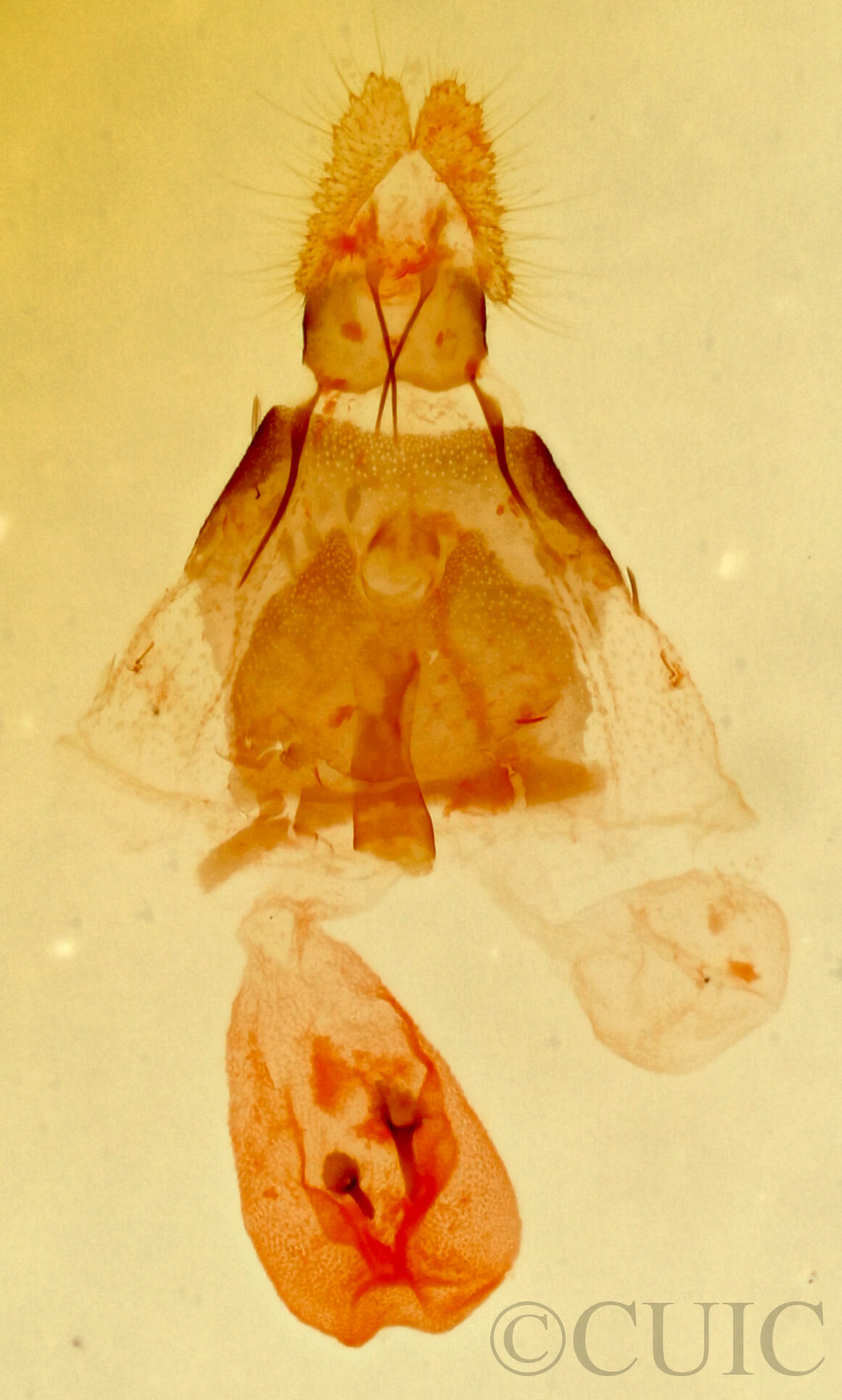 genitalia view of adult Hendecaneura shawiana