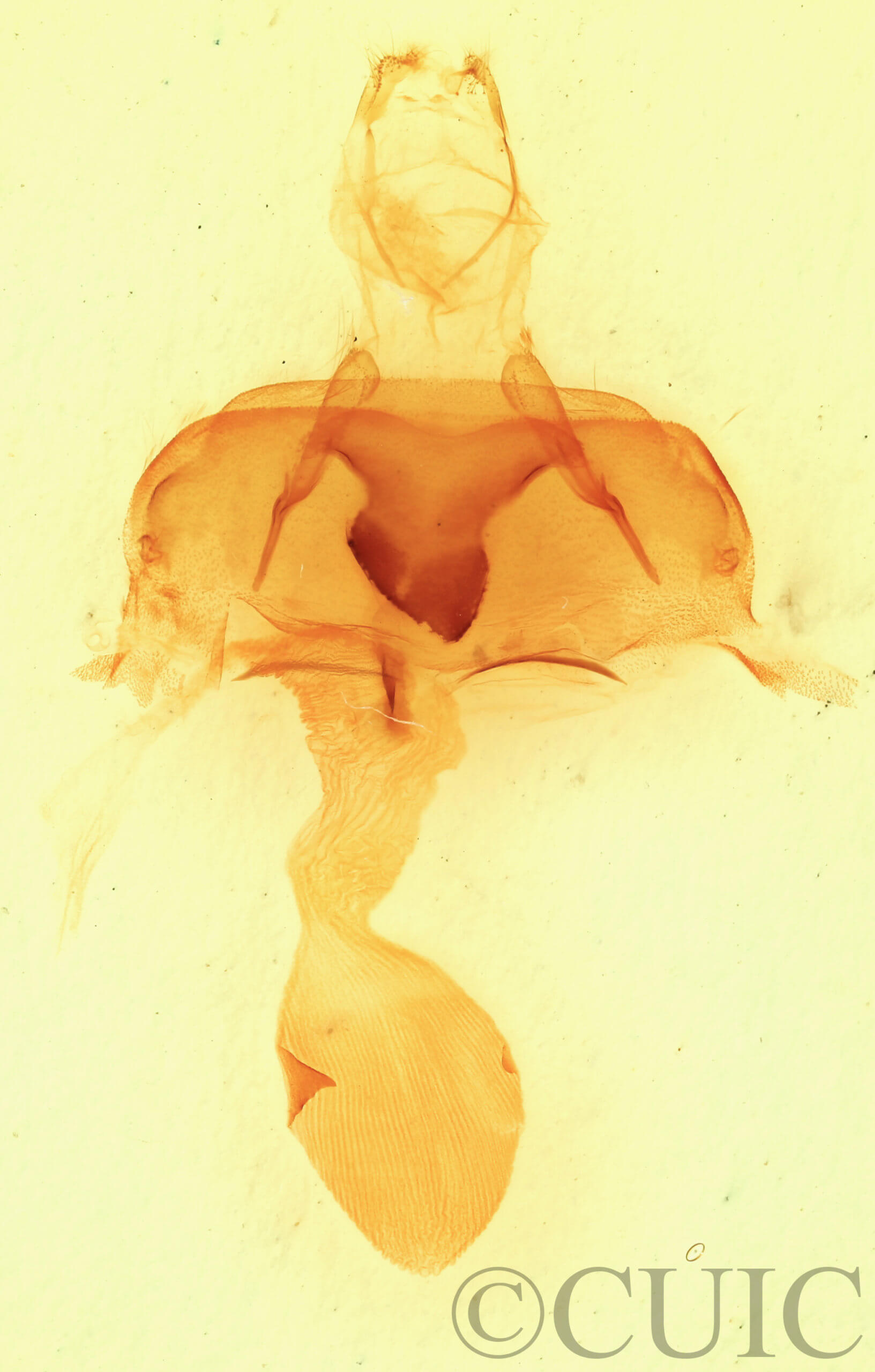 genitalia view of adult Abagrotis alampeta