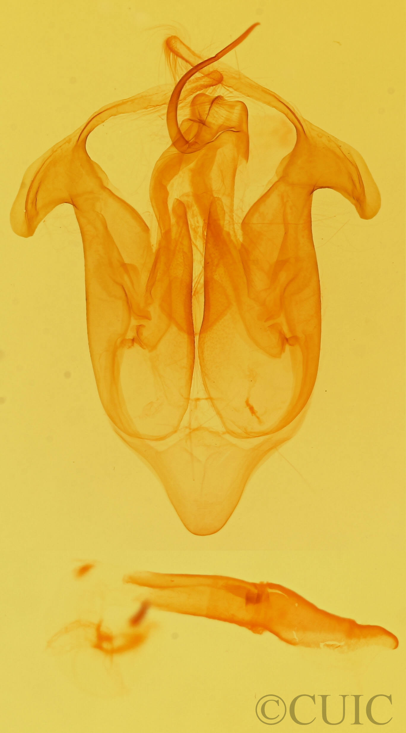 genitalia view of adult Eutelia furcata