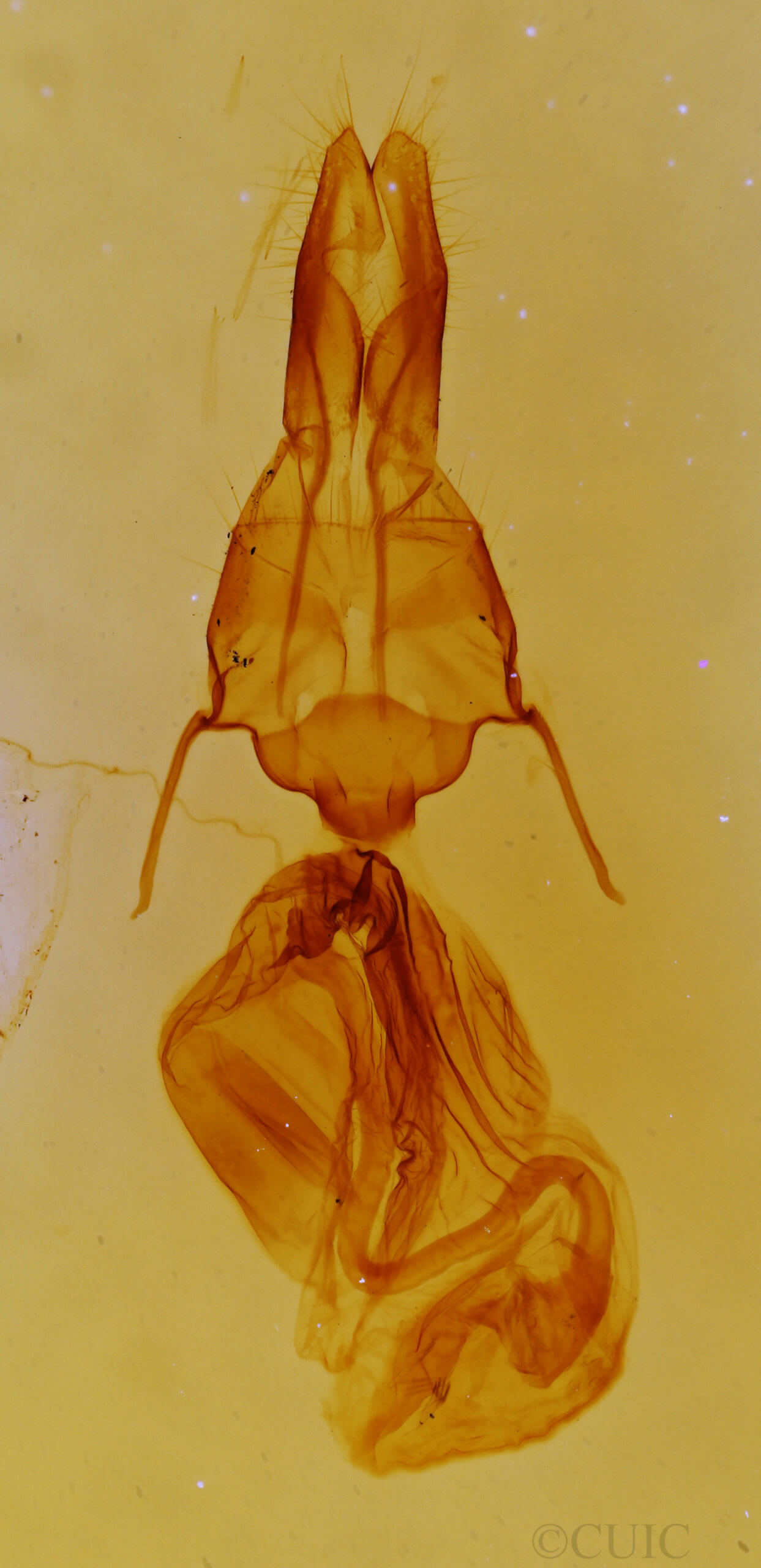 genitalia view of adult Mythimna formosana