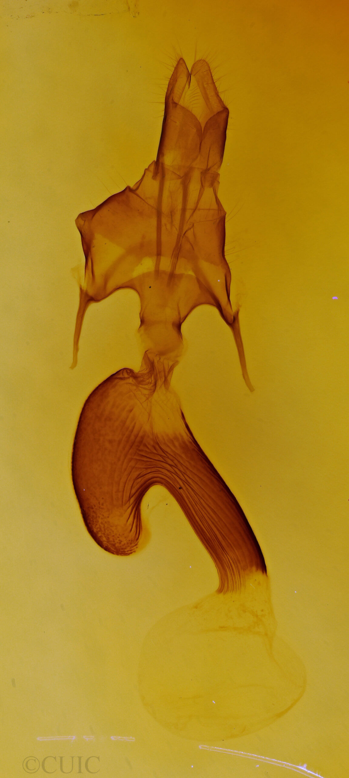 genitalia view of adult Mythimna formosana