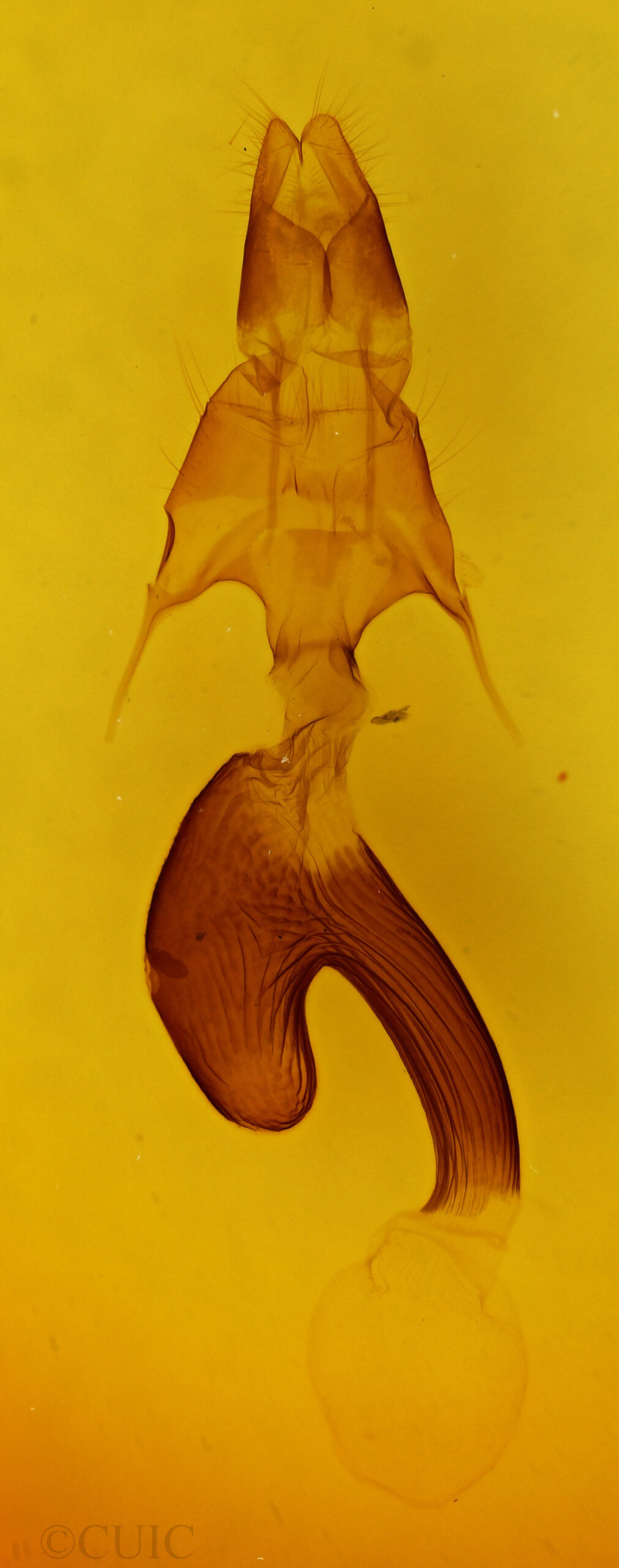 genitalia view of adult Mythimna formosana