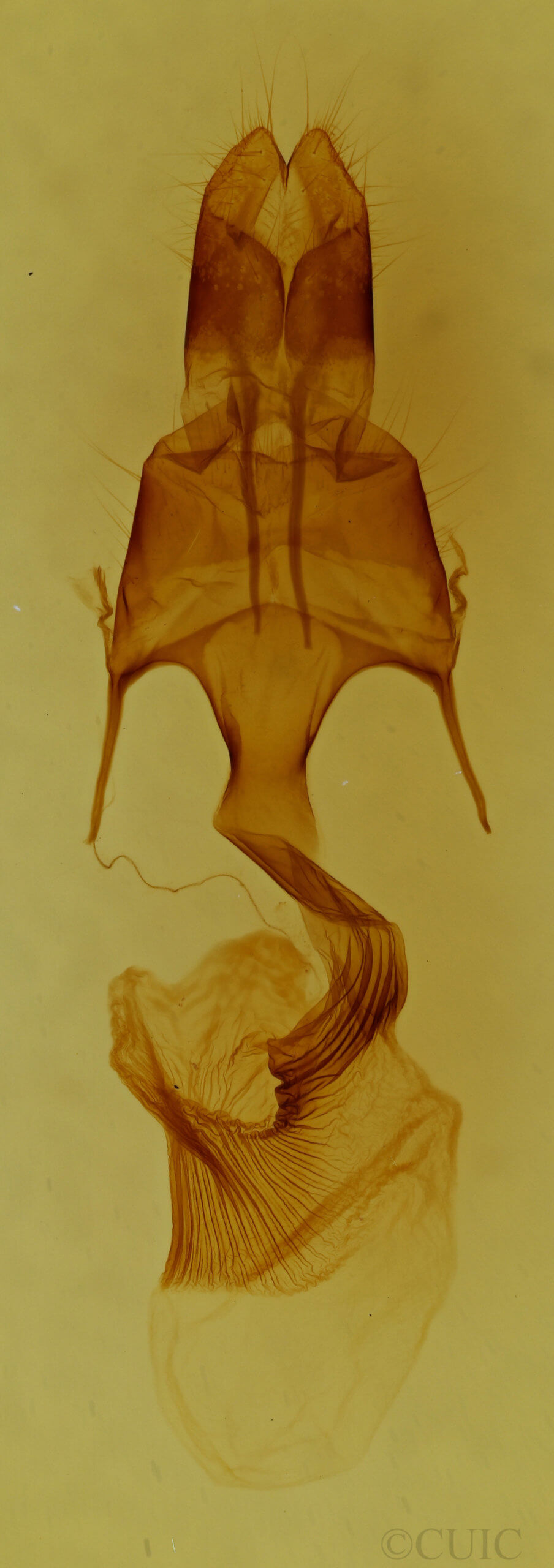 genitalia view of adult Mythimna lipara